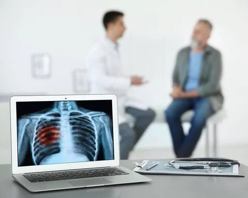 Costul stigmatizării și autoînvinovățirii – vieți pierdute. Campania „Inspiră Speranța – Pune Întrebarea Potrivită” spulberă prejudecățile în cancerul pulmonar