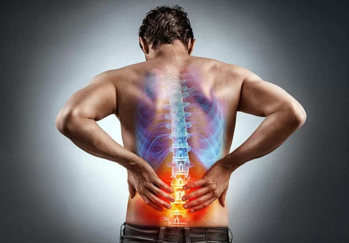 Simptomele și cauzele durerii de spate